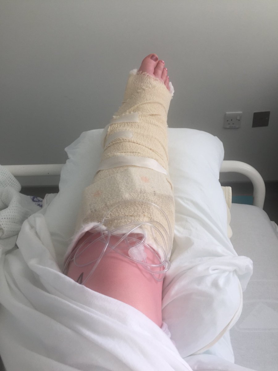 TheAyeLife's tweet image. 12 pins, 2 plates. That’s the last time that dog gets a walk. #Broken #Buggered.