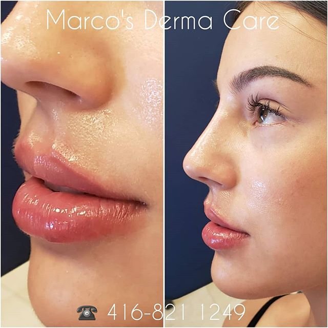 marcos derma care