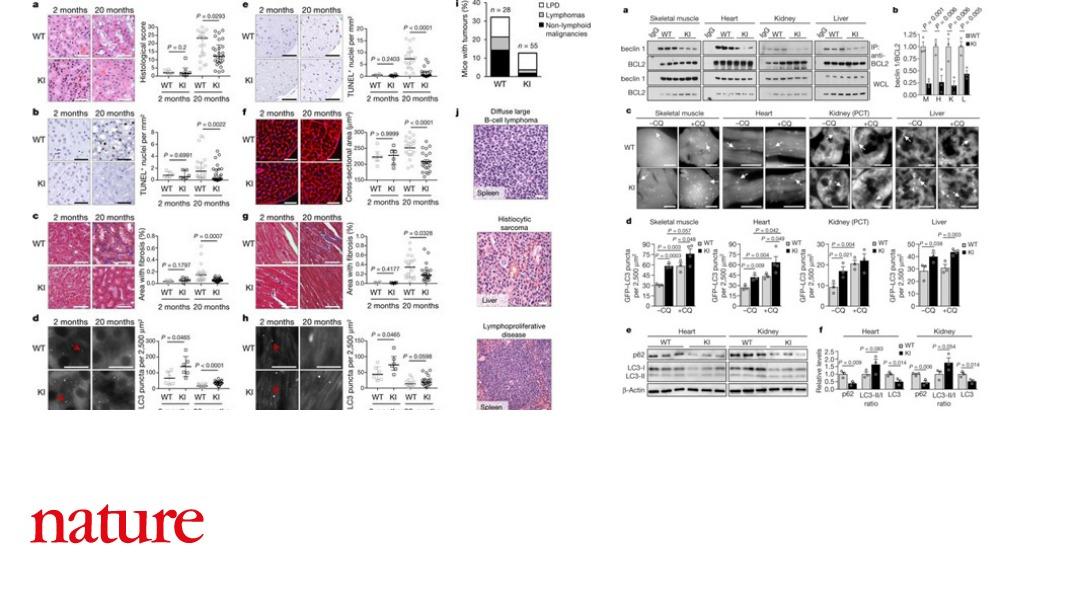 A mutation in a protein crucial to the cellular process of autophagy is shown to increase both healthspan and lifespan in a study in mice published in Nature go.nature.com/2L9Iup5