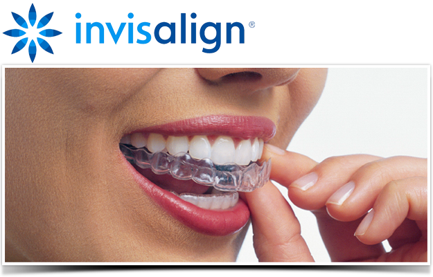 MillsapsDentist's tweet photo. We now offer @Invisalign Call today for a Consultation! #hickorydentistry #millsapsdentistry #invisalign https://t.co/xm5cqUPFAC