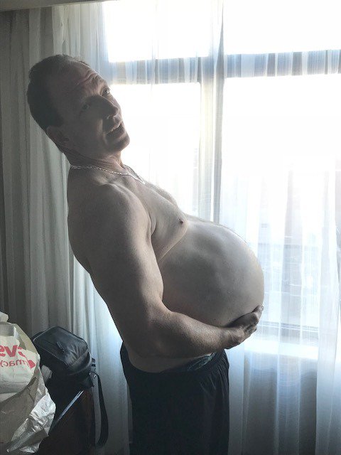 bigdumbkidneys's tweet photo. Say farewell to Big and Dumb. The @MayoClinic team has successfully removed both of Gene's kidneys. Bill is recovering from surgery, and the greatest gift is on the way to Eugene. Long day. Big progress. More updates to come. Keep sending your prayers and positive energy. #PKD https://t.co/pZgetZ2fU0