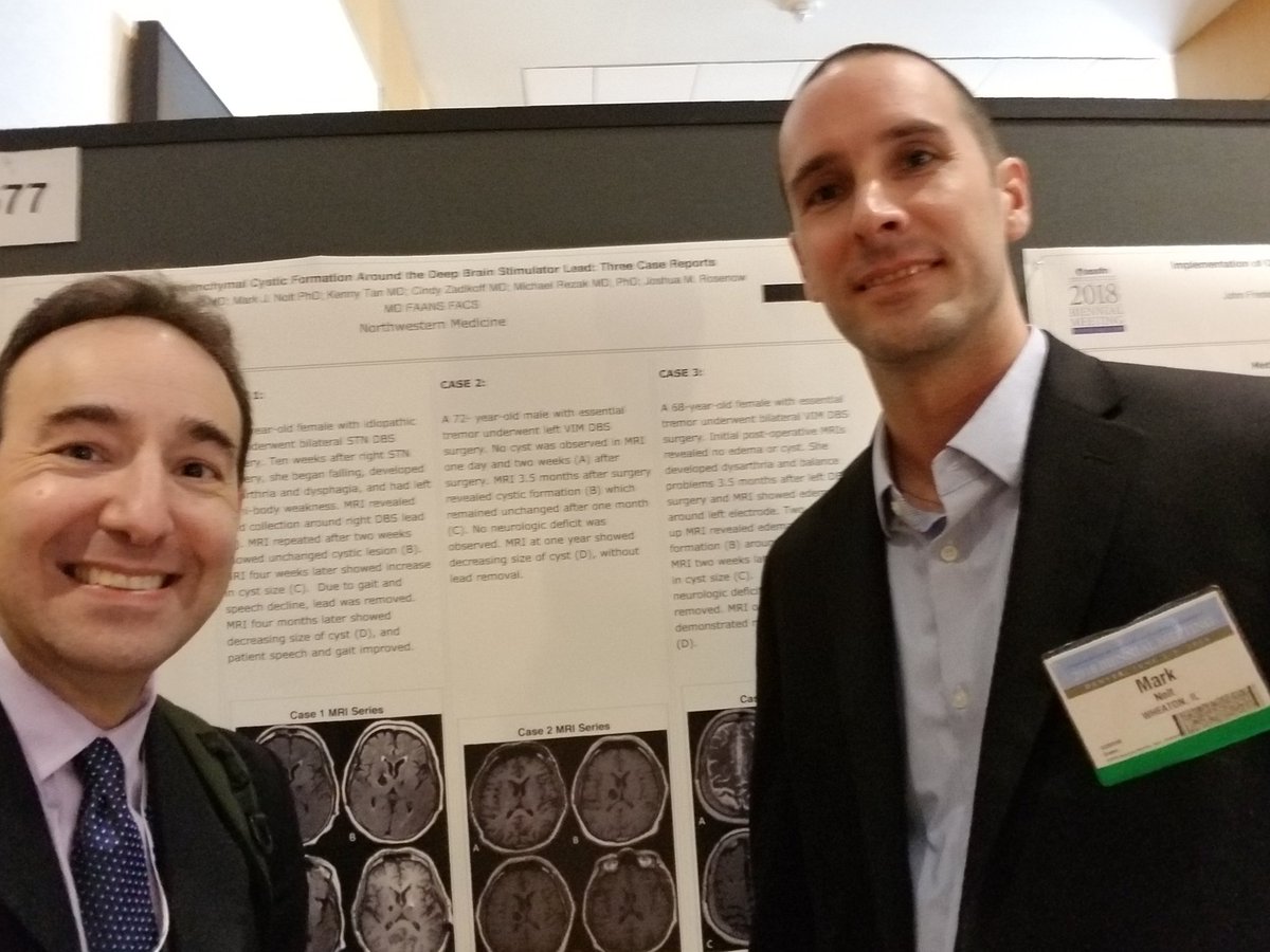 joshuarosenowMD's tweet photo. With our extraordinary neurophysiologist mark Nolt, presenting our series of #DBS lead cysts. Largest reported group. #assfn2018 @NeurosurgeryNM @NorthwesternMed @NM_365 https://t.co/xPNbj1xJhX