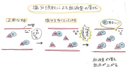 ミールタイム 公式 Twitter ನಲ ಲ そもそもなぜ 塩分 をとるといけないのか かんたんに血圧が上がるメカニズムをイラストにしました 塩分制限をすべき理由がわかるのと やみくもに我慢するのとでは意識が変わってきますよね 高血圧 血圧 塩分