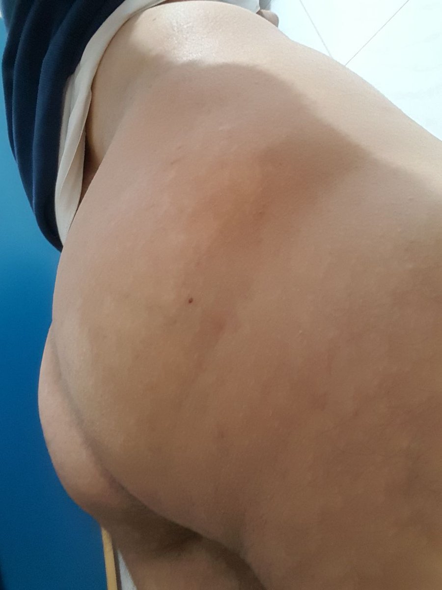 CemAk98558378's tweet photo. #Mersingay #mersinerdemli #mersintarsus #Mersingay ap #mersinmerkez #mersinaktif # Mezitli #mersintoroslar #Mersingay #mersinerdemli #mersintarsus #Mersingay ap #mersinmerkez #mersinaktif # Mezitli #mersintoroslar 05399457176 arayin https://t.co/HUZvczPFJU