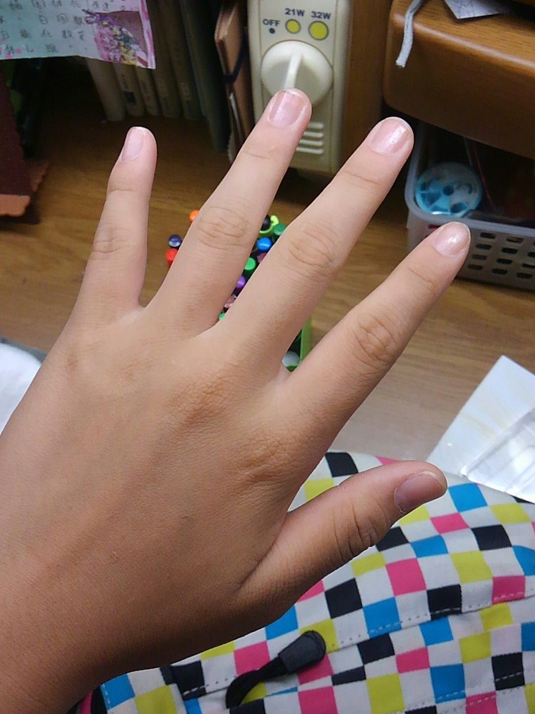 治樹 手を晒して女に見えたらrt男に見えたらいいね 汚い手で Q ｻｰｾﾝ あと絶対来ないwwwwww T Co Ryzszuvvg7 Twitter