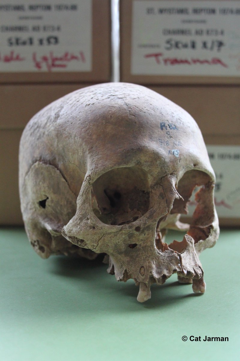 AntiquityJ's tweet photo. Free #archaeology! 💀 As @CatJarman et al. return to Repton for the #GreatHeathenHunt, read 'The Viking Great Army in England: new dates from the Repton charnel' 2018 - @CatJarman, @martin_biddle, @tommyhigham & C Bronk Ramsey: https://t.co/fmlX4vxqw6
#REP18 #OpenAccess #Vikings https://t.co/IBzjzBdDm2
