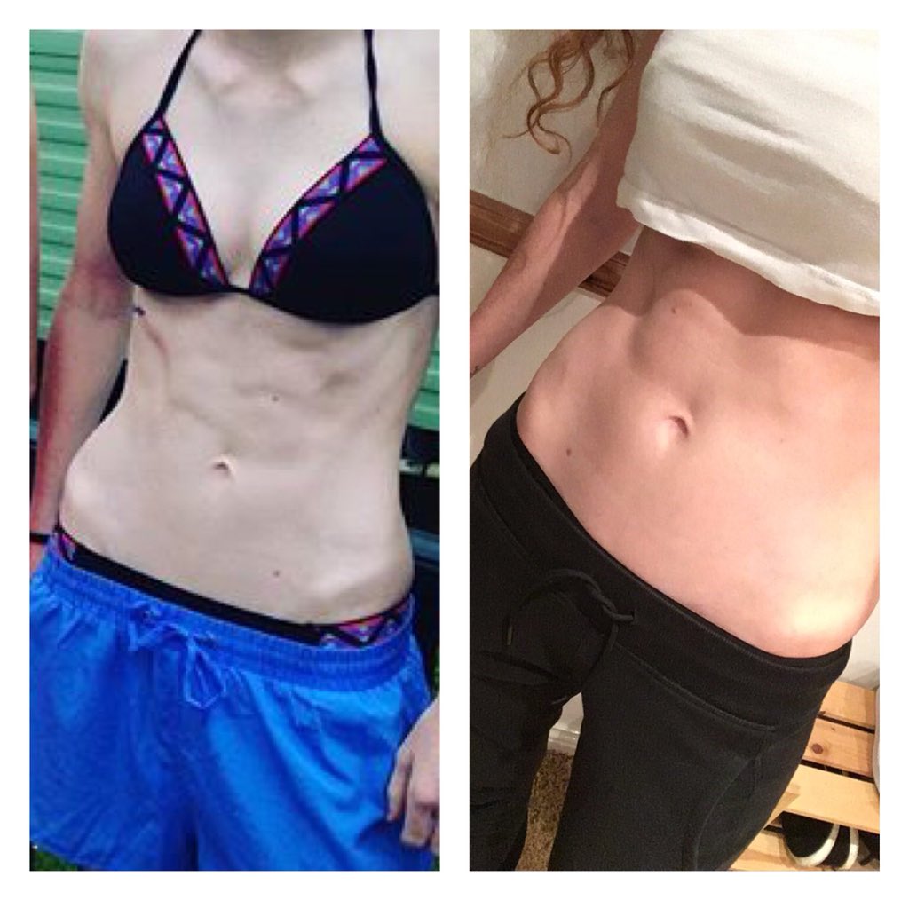 LMFitness123's tweet photo. My thoughts about “skinny” and current health update💪🏼 life is a constant learning curve and I’m always willing to listen and take note #health #fitness #fitness #hardwork #weightgain #notweightloss https://t.co/a0k7yfSI7w