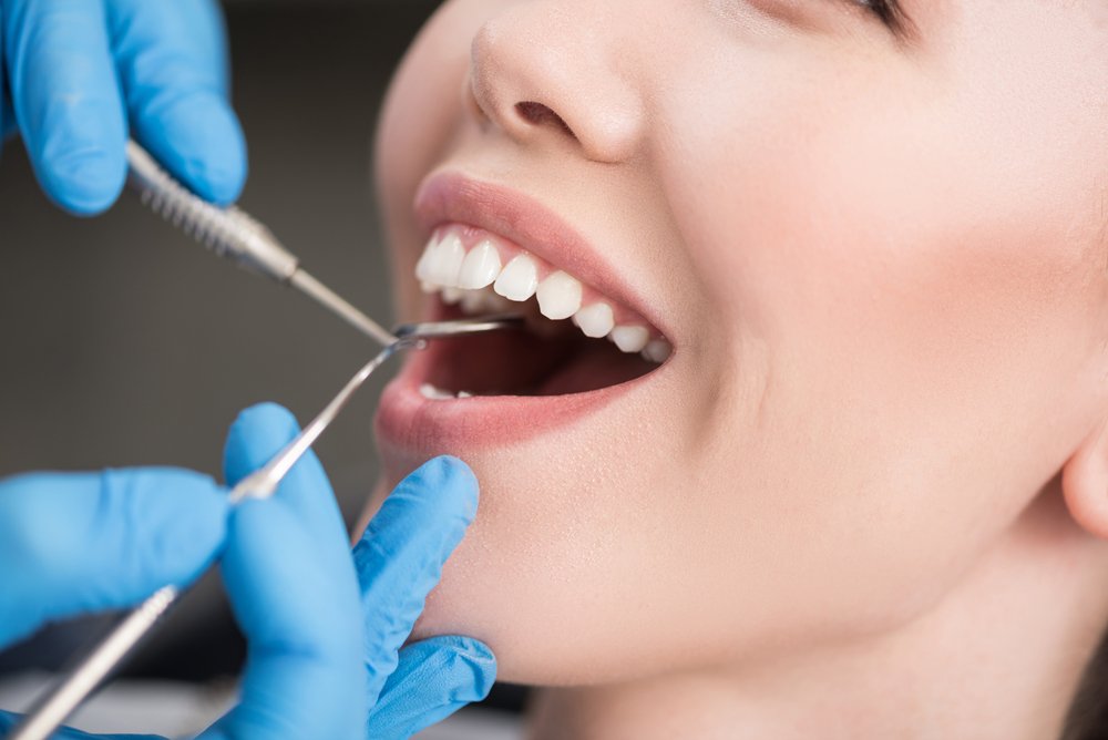 Have you scheduled your annual cleaning yet? Dental cleanings don't only give you a fresh smile, there are many health advantages. Come in before it's too late!

 bit.ly/2k6U3SB