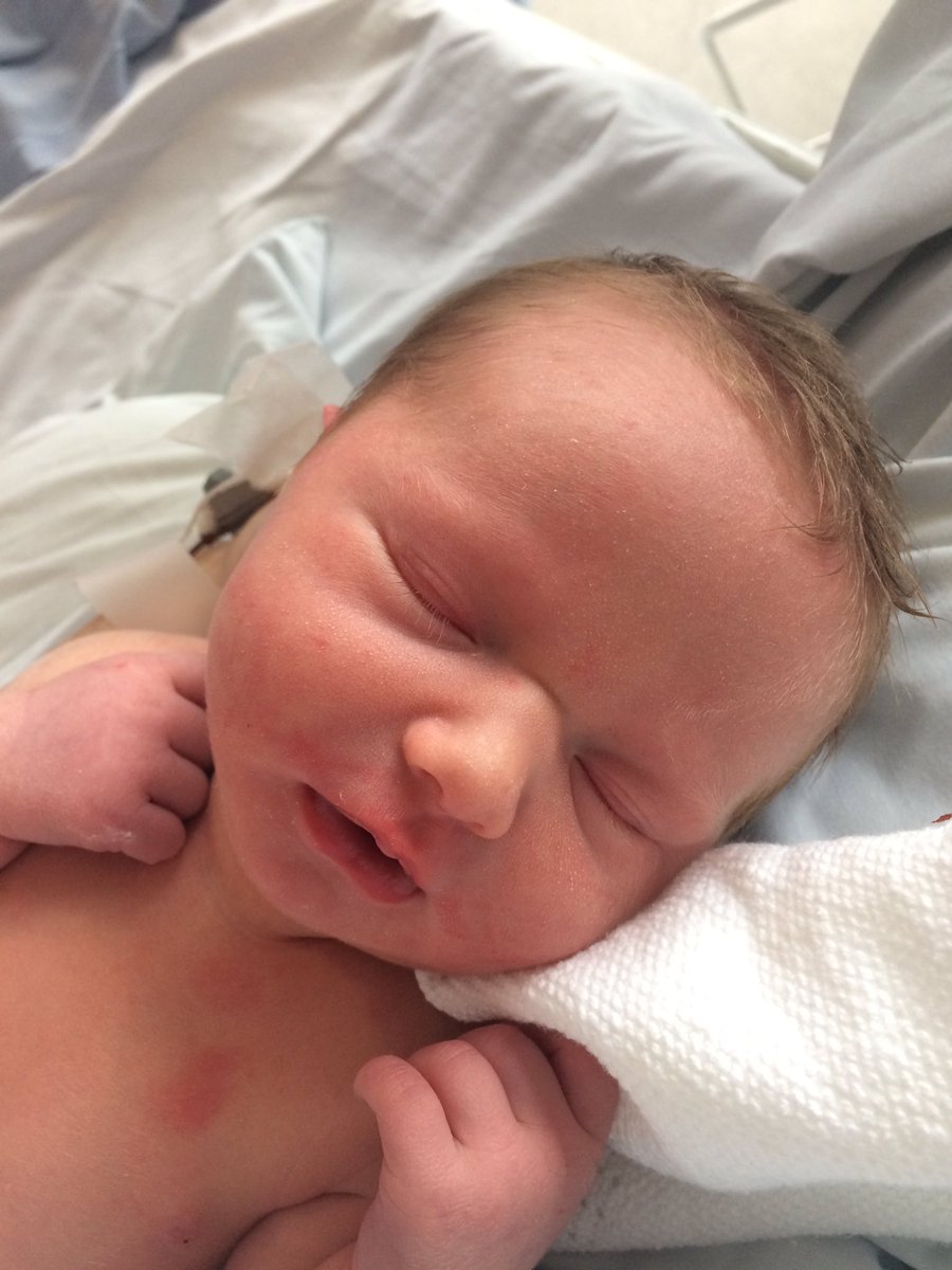 keeley_dring's tweet photo. Meet Isla ❤ potential future employee of #teamsfht 👌🏻#nursing https://t.co/rlTVxxdm8y