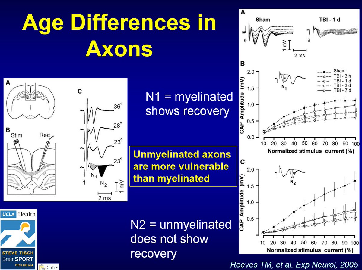 griz1's tweet photo. #3=Axonal biology: Sex & age distinctions. Relevant considerations for injury #TBI #concussion protective equipment. @ASTMIntl @ansi_astm @UCLAHealth @UCLAMCH @NeuroTrauma18 @Neurotrauma @DrDBCamarillo @strowson @Stefan_M_Duma @adityaponnaluri #ASTM2018 https://t.co/cC04usYgE6
