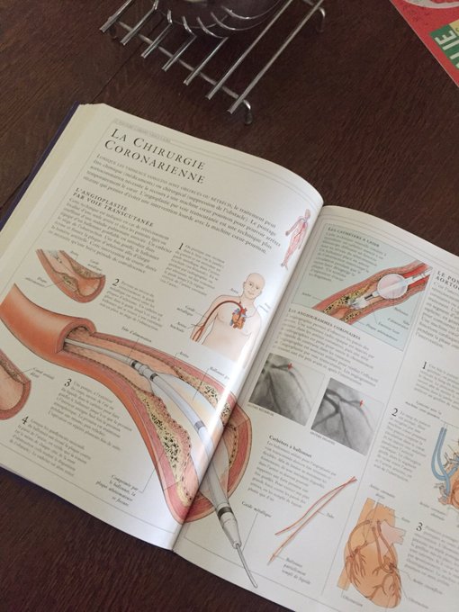 Se pr&eacute;parer car muter en USIC 😒🤓🧐🤯 #help #caregiver #aidesoignante5⭐️ https://t.co/68SxiD1IVf<a href="/tag/help"class="tags">#help</a><a href="/tag/caregiver"class="tags">#caregiver</a><a href="/tag/aidesoignante5"class="tags"><span>#aidesoignante5</span></a>