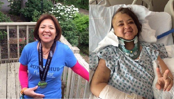 GoGetFunding's tweet photo. Melissa was seriously injured when a falling tree crushed her, but the campaign to get her well again is a huge success - over $23,000 raised already! https://t.co/tk7lVYVeZ7 #HelpMelissa #Success #GoGetFunding https://t.co/Zn0EW90I8s