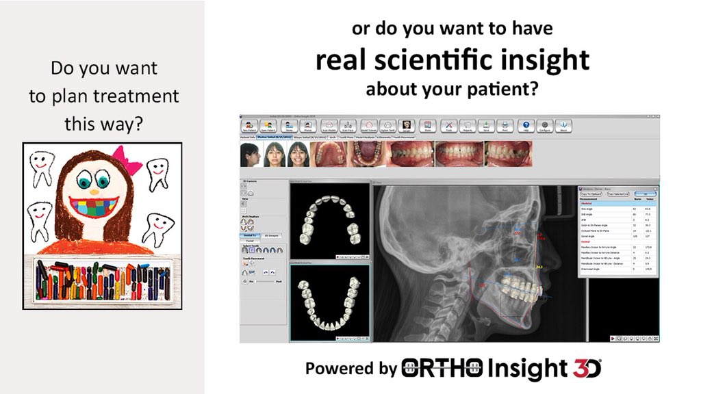 Iprint3dsmiles's tweet photo. How do you want to plan treatment?  #3dorthodontics #orthoinsight3d #automatedaligners #2dimaging #3dprinting #scientific #orthodontics #diagnosticsetup #3dtxsimulation #easyaligners #digitaldentistry  #analyze #scan #plan #print #treat https://t.co/mfloRaPbcL