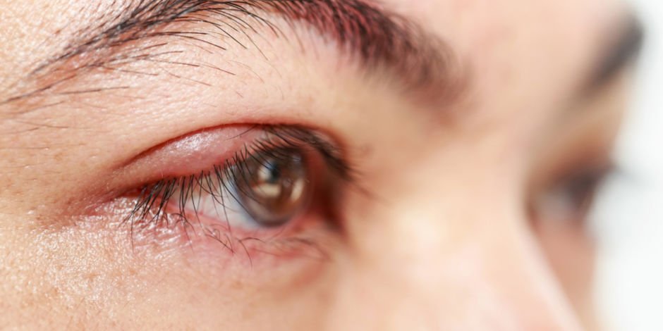 #SaludVisual✅👀
¿Cómo se producen los #orzuelos? Te ayudamos a curar rápidamente estas infecciones habituales en los párpados: 😖💢👁
bit.ly/2GyHjgd