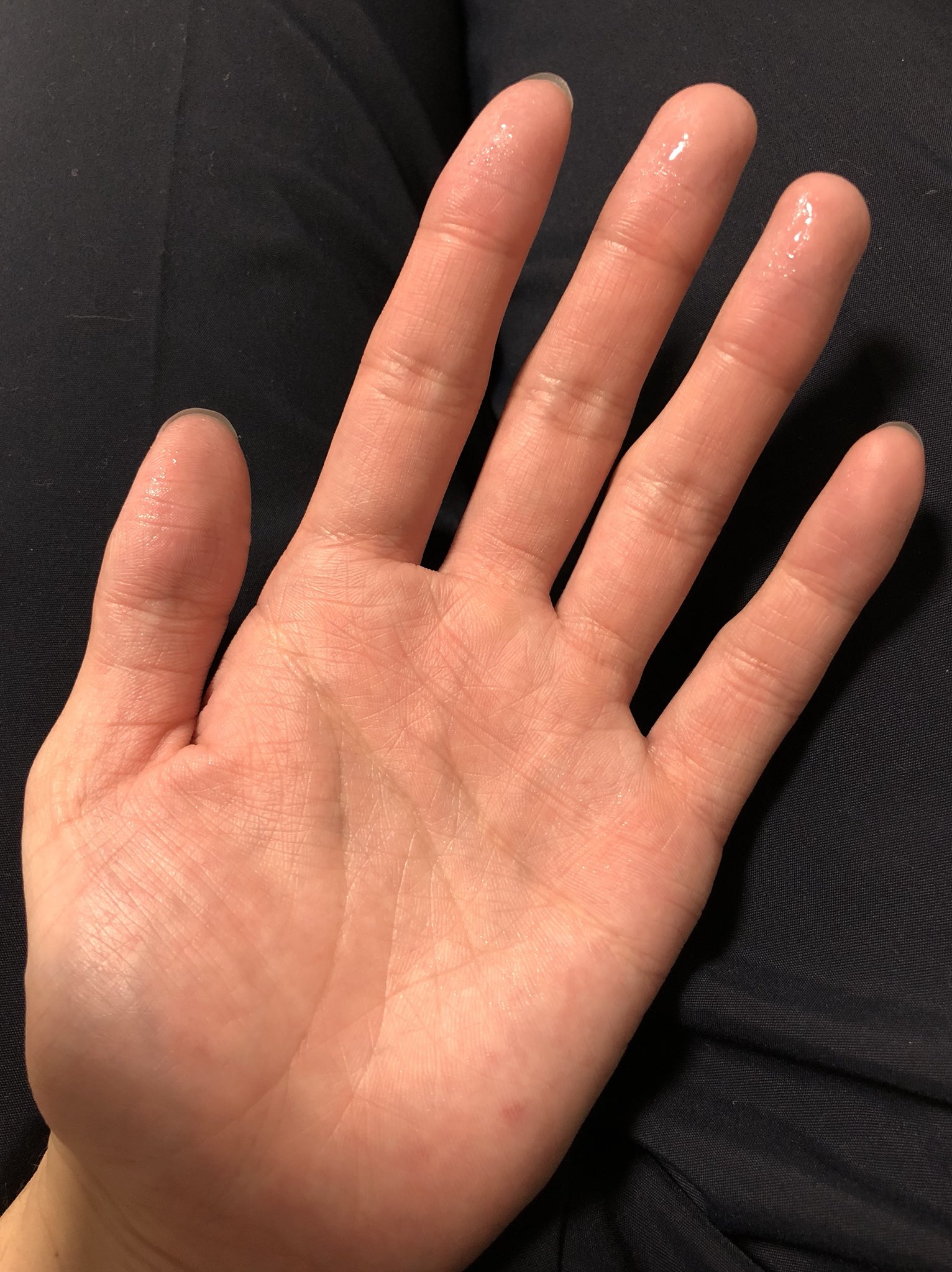 Ara 自分もイオントフォレーシス絶賛使用中なのですが やっぱ指先は効きづらい それと第二関節のとこがサラッサラw T Co Guz4rib9ov Twitter Ara 自分もイオントフォレーシス絶賛使用中なのですが やっぱ指先は効きづらい それと第二関節のとこがサラッサラw T Co Guz4rib9ov Twitter