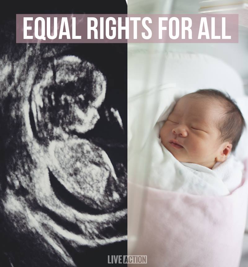Women's rights begin in the womb. To be pro-life means to value the life of the woman and her preborn child equally. #Retweet if you agree!