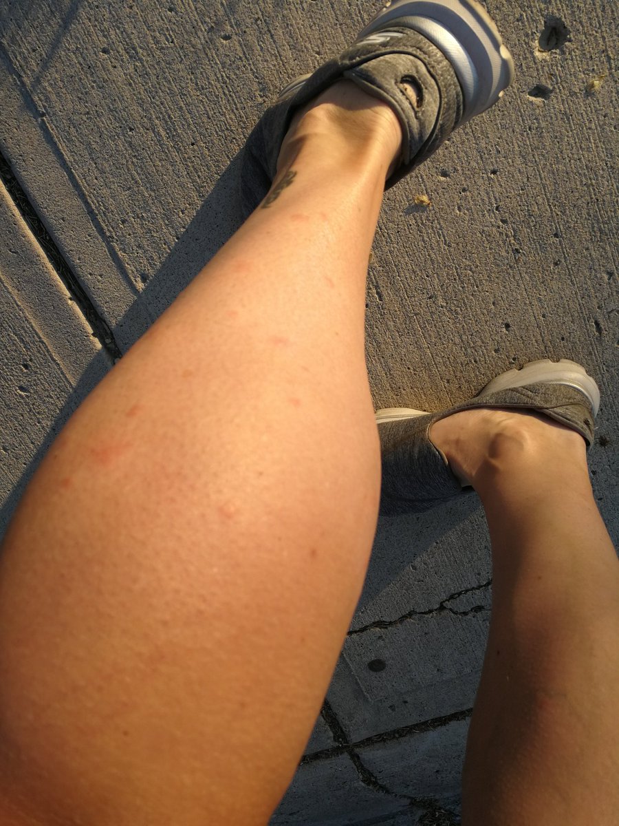CalgaryRugbyRef's tweet photo. Don't forget your sunscreen and insect repellent (spray before going on the field) tomorrow. The mosquitoes love rugby! #rugbyday #yyc #attackofthemosquitoes https://t.co/BzUspKepcy