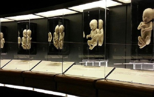 Incredible Display With the Bodies of Miscarried Babies Reveals the Humanity of Unborn Children bit.ly/1PVaE7F #SaveThe8th #savethe8thvoteno