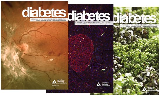 Did you know you don't have to be a Diabetes author to submit cover art? Send us your interesting images to be considered! diabetes.diabetesjournals.org/content/images…