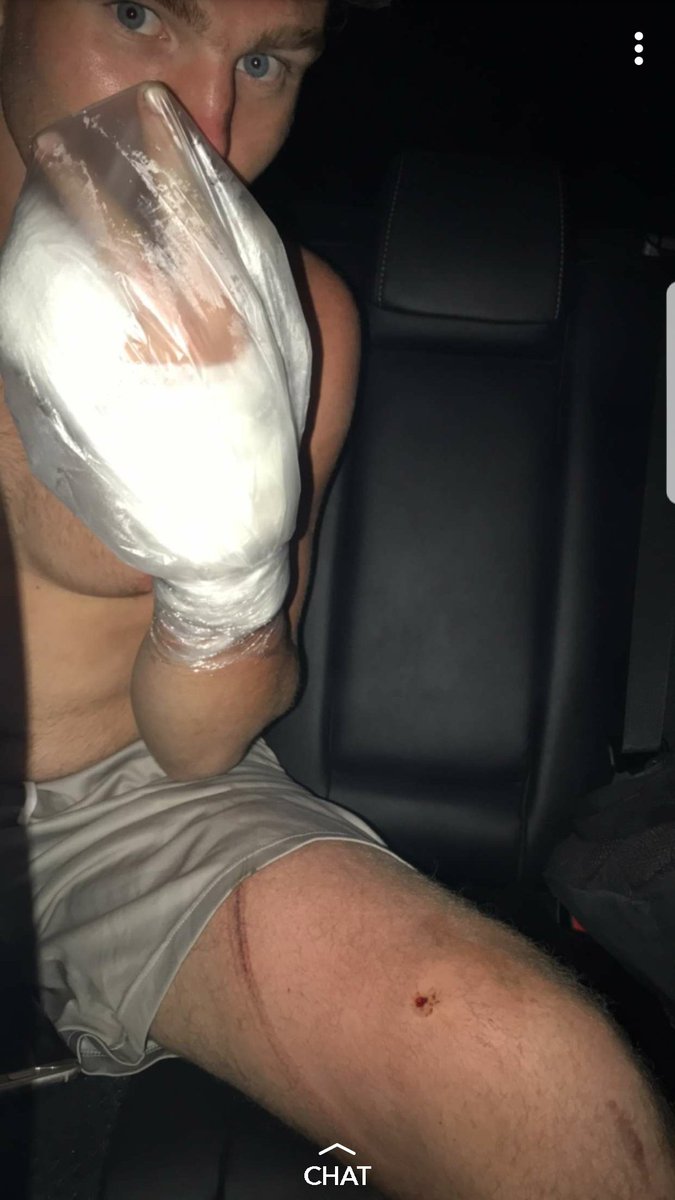 brycewebb14's tweet photo. Thank you to everyone for sending me best wishes to get better. Ill be good. I got lucky and didnt break any bones. God saved me on this one! https://t.co/fiQv8zQyNi