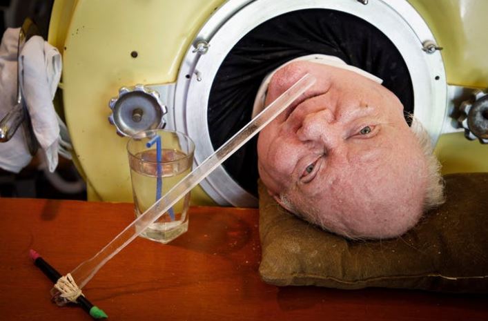 Life inside a canister: Dallas polio survivor is one of few people left in U.S. using iron lung dallasnews.com/news/science-m… #ironlung
