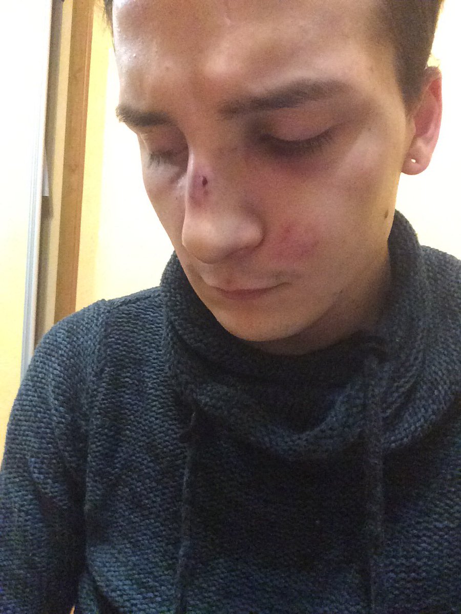 kill_____kill's tweet photo. Бутерброд падает маслом вниз, а я падаю ебалом вниз  
#beautiful  #счастье https://t.co/mCHmy4DEde