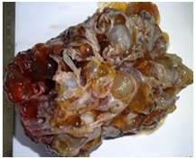 editorijcrr's tweet photo. A clinicopathological study by Manzoor et al was conducted at ASCOMS, Jammu has revealed that Ovarian carcinoma represents the sixth most common female cancer and the fourth leading cause of death due to cancers in women.
https://t.co/oT2GbnM5Cf https://t.co/hk4oXfYYHa