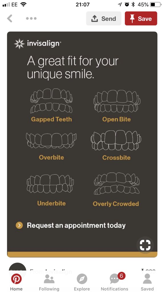 TheSmileWorks's tweet photo. Book your consultation today and receive £150.00 off Invisalign. https://t.co/zMJxfM7dkN
