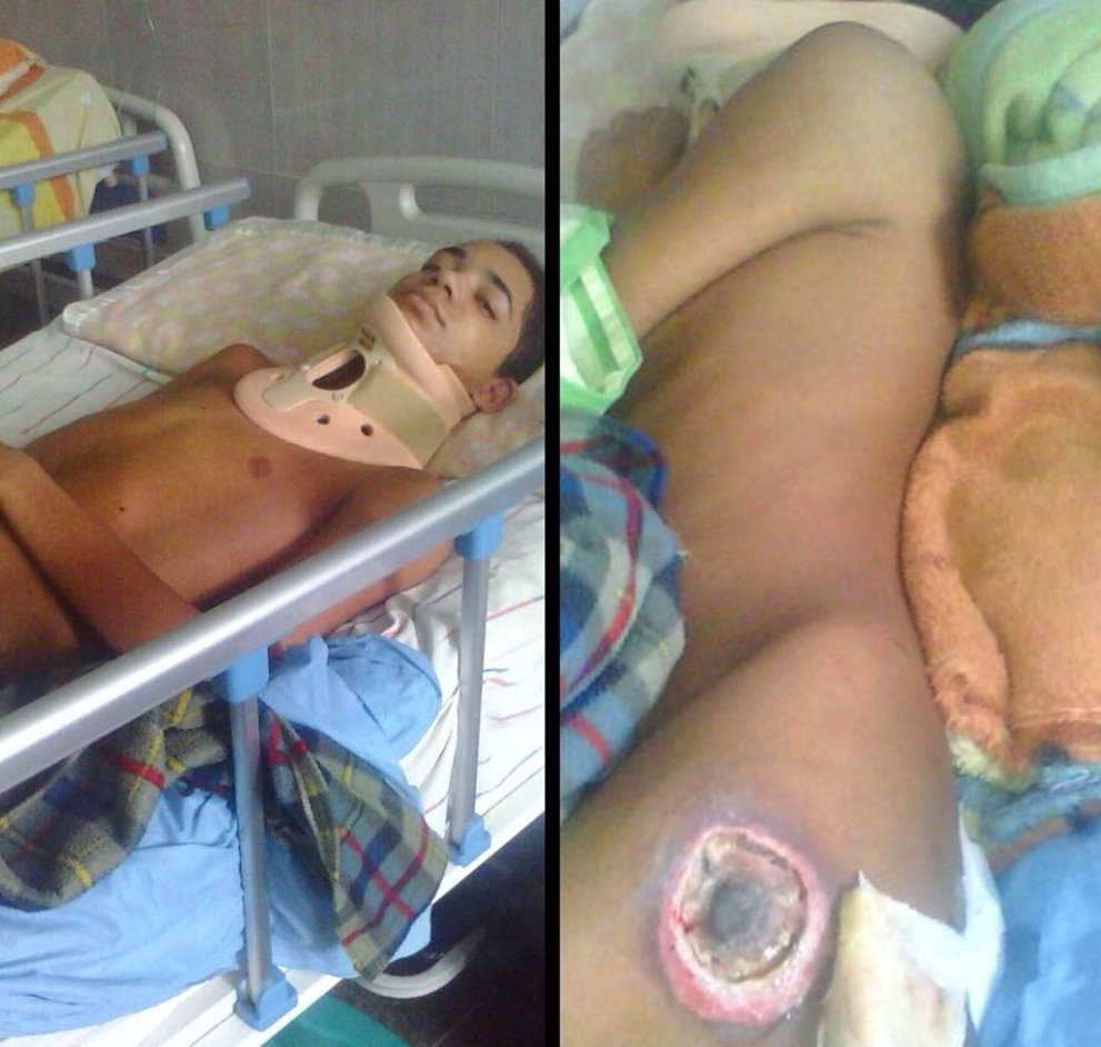 ESEdeSalud's tweet image. José Martínez (17 años). Lesión en Médula por traumatismo, espera ser operado. NECESITA comida e insumos para curacion de escaras, colchón antiescaras. San Felipe Hospital Central. 0426.4605861 
Contacto @eslabonesdeamo1

#ServicioPublico * Retweet y ayuda a difundir! #ESEdeSalud