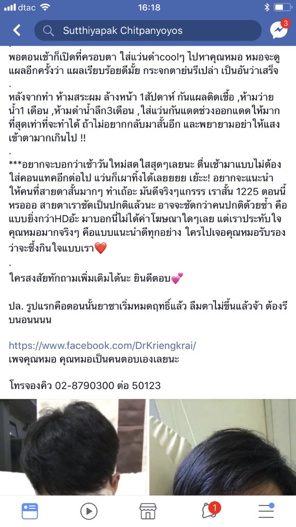 mefauy's tweet photo. เมทรีวิวทำเลสิคสำหรับคนสายตาสั้นมากมาก ดูไม่น่ากลัวดูฟรุ้งฟริ้ง #ไว้รีวิวห้ามขายของโว้ยย https://t.co/ktI6fHJQ5R