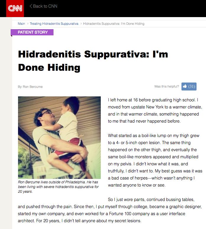 HSisNOTu's tweet photo. "Most importantly, don’t be afraid to share your #HidradenitisSuppurativa story. Fight the stigma. I am done being ashamed of this condition. I’m done hiding." #iwillnotHIDE #HidradenitisSuppurativa = #HSAWARENESS  https://t.co/2N4lb33GPA https://t.co/ZXKORmh7WM
