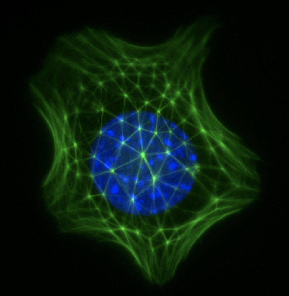 deniswirtz's tweet photo. Rare geodesic architecture of actin (green) on top of the nucleus (blue). Mouse embryonic fibroblast https://t.co/zkvx97pg4F