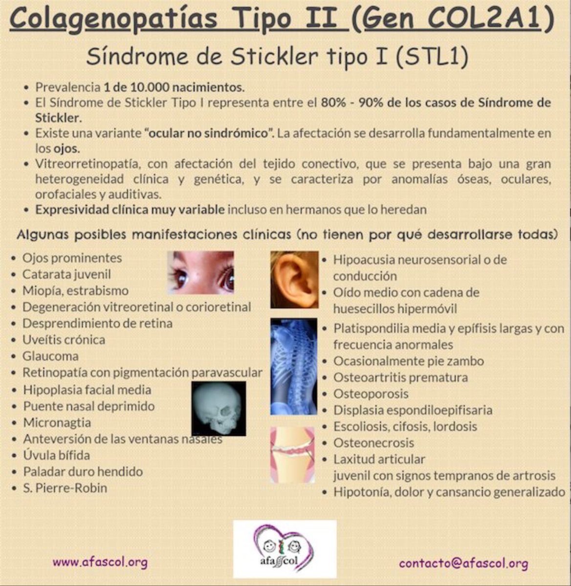 NoInvisibles's tweet photo. Hoy concienciación #ColagenopatíasTipoII
Conocer más y mejor #COL2A1
Diversas condiciones debidas a esta mutación
#Stickler #SEDC #Strudwick #Kniest
#Perthes #Stanescu
Conocer, visibilizar e investigar
Es el camino y la esperanza
Gr. @AFASCOL @COL2A1Chile
Cc @InfoAliber https://t.co/HXSLSgLy8T