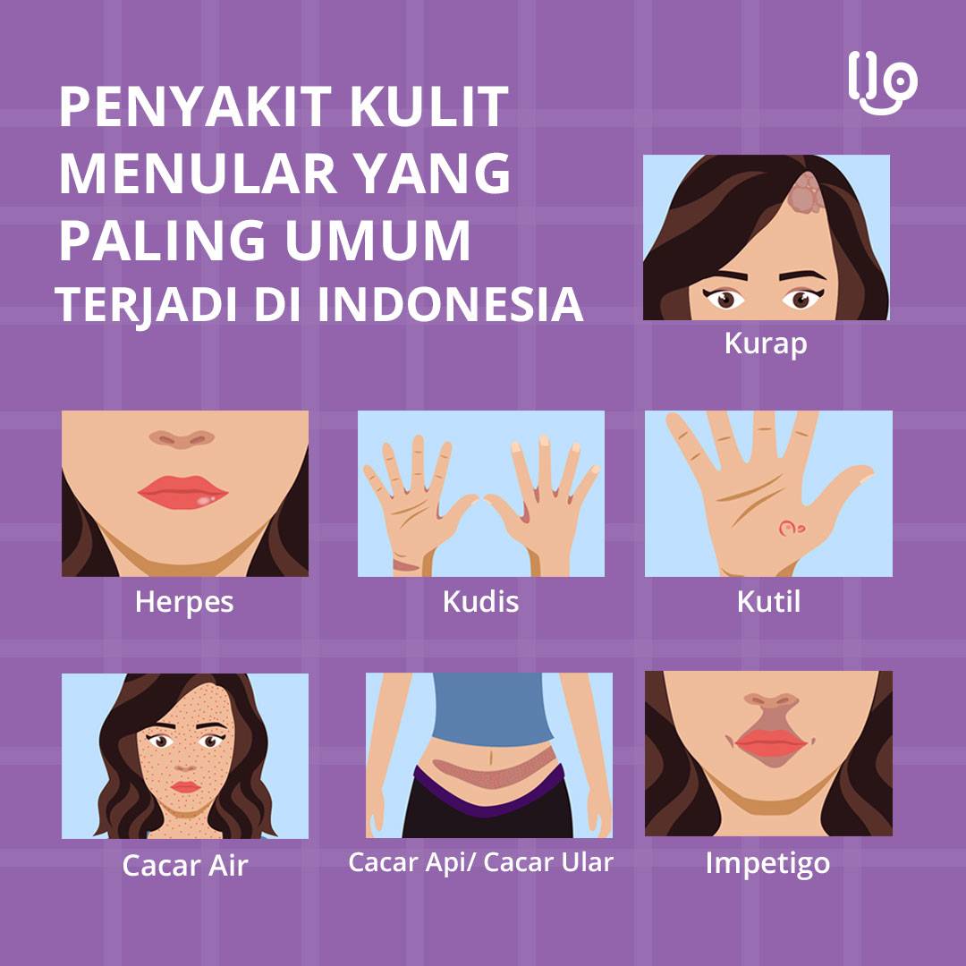 HelloSehat's tweet photo. Di negara tropis seperti Indonesia, ada beberapa jenis penyakit kulit menular yang sering terjadi. Apa saja? Simak pada gambar ya, Sobat Sehat!
.
#penyakitkulit #penyakit #indonesia #jakarta #hellosehat #hellohealthgroup https://t.co/7WNFzFZG6s