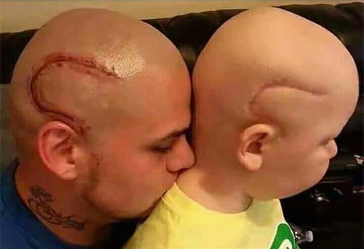 OwusuSamG's tweet photo. #DaddiesAndTheirKidsChallenge
Dad tattoos son's cancer scar on his head to boost his son's self confidence. https://t.co/OYlQMaDDDo
