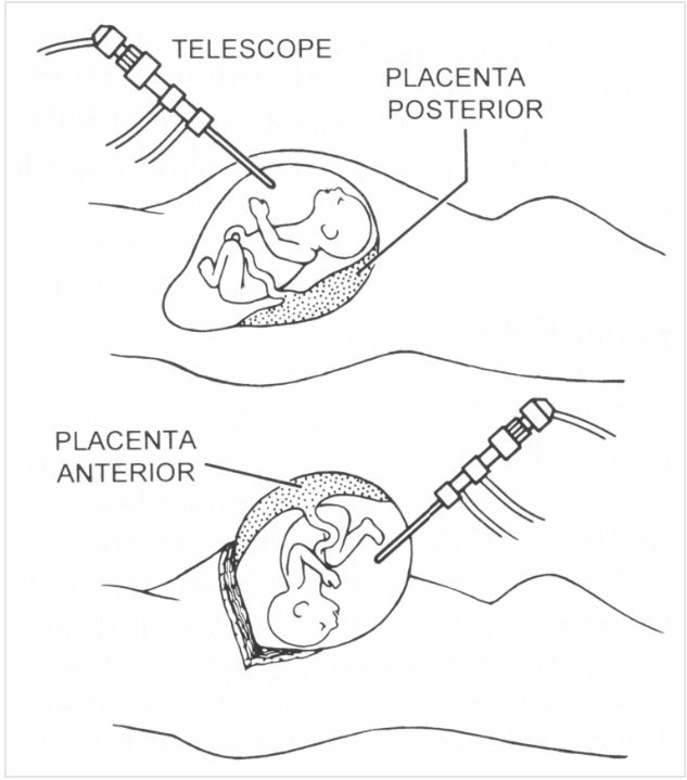 UCSF Transplant tweet media