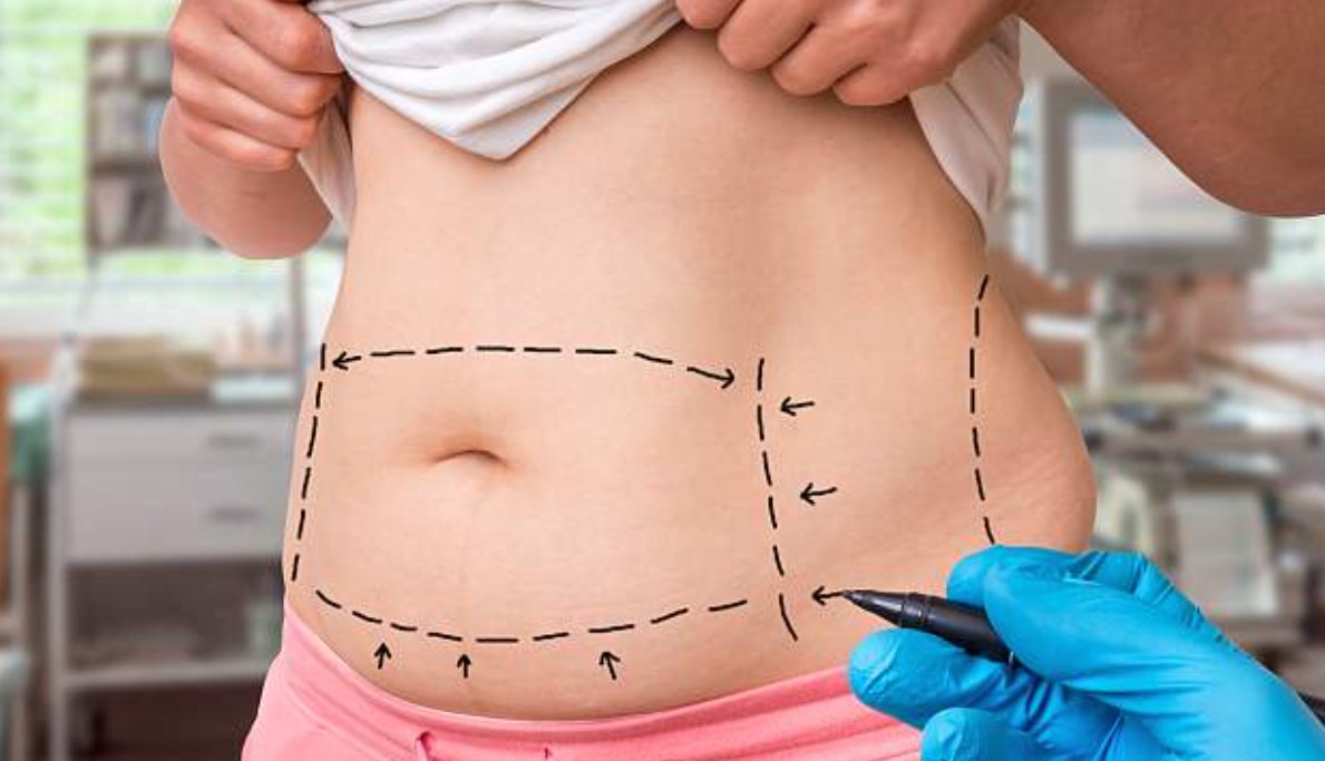 The #mummymakeover is customised to suit each patient's #postpregnancy needs.  <a href="/DailyMailUK/">Mail+</a> <a href="/MrMarkHenley/">Mark Henley</a>   
dailymail.co.uk/femail/article…