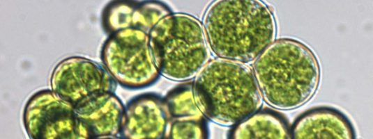 La chlorelle : une solution santé #chlorella #futureoffood #detox #microalgues #healthy #superaliments via <a href="/OuestMagazine/">Ouest Magazine</a> bit.ly/2scoB9M