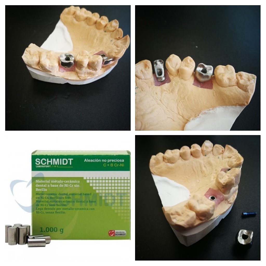 Schmidt_SDS's tweet photo. Es increible la labor que ha realizado Salvador López Navarro con nuestro producto Metal #SchmidtLine para #Esqueléticos 👏
¡Nos encanta conocer vuestro trabajo! 😍
Más artículos para #LaboratorioDental ➡ https://t.co/5UmVVqwqbw https://t.co/EpRhZf1tv8