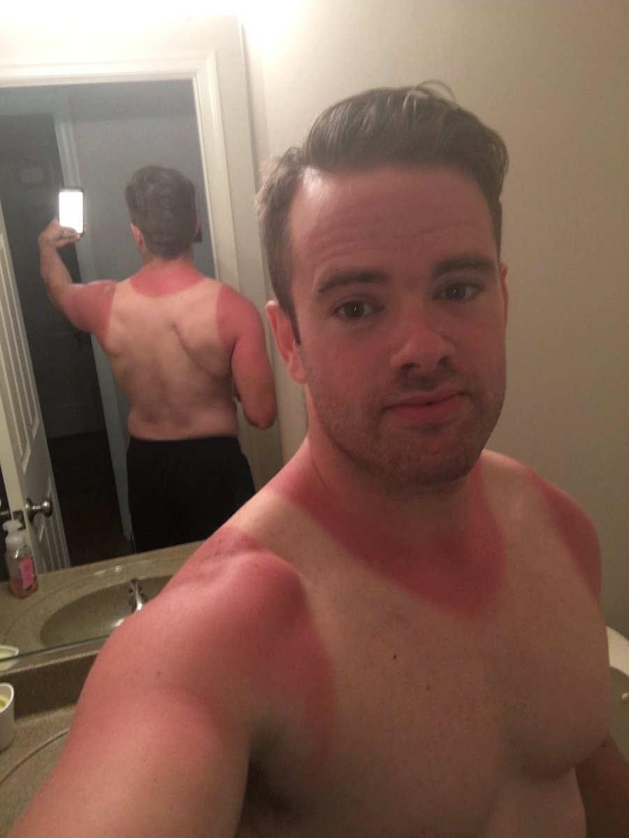 GatorNeedHisGat's tweet image. What is sunblock? #couldhelp #maybenexttime #notashirt #datscardoe