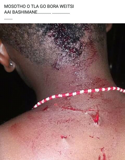 Sosha_Hustler's tweet photo. This guy stabbed this lady for rejecting him to go with him at club. RT to get this guy in jail. case has been opened from @SAPoliceService. Case registered on 2018-05-28 at RIETGAT ref nr CAS 526/5/2018. In Mabopane. @iamdjman help https://t.co/6SMsf57CF9