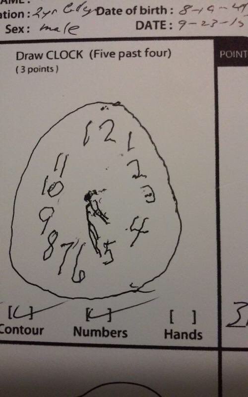 ⚠️ Good news for anyone suffering from Dementia/Alzheimer’s ⚠️ Dr J Douglas Brown in Alabama, who is a <a href="/Carrickinst/">NeurologyCI</a> trained functional neurologist, provided me with pictures of a patient doing a test for dementia &amp; his progress over a 10 week period with the proper treatment