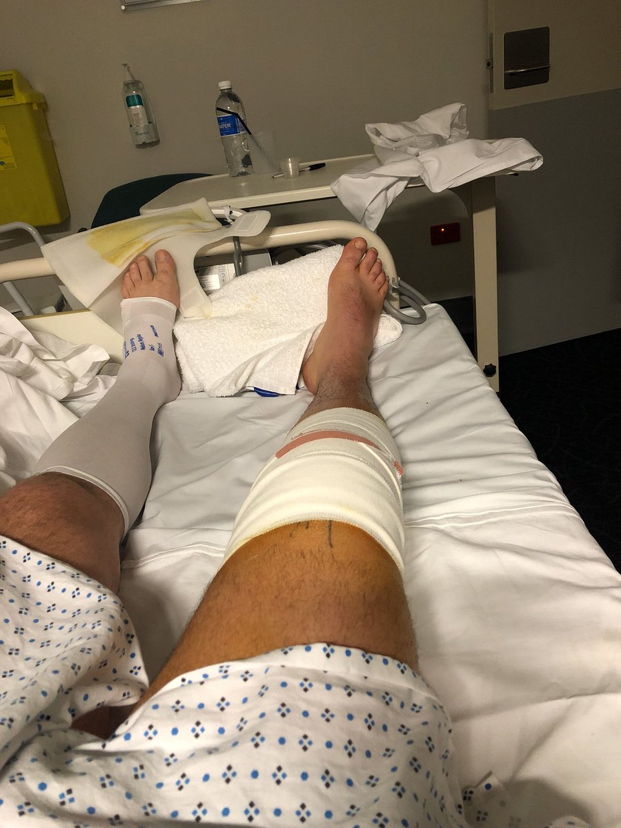 mitchcarroll13's tweet image. 5am pain killers yes please #drugmeup #layedup #footy #soreknees