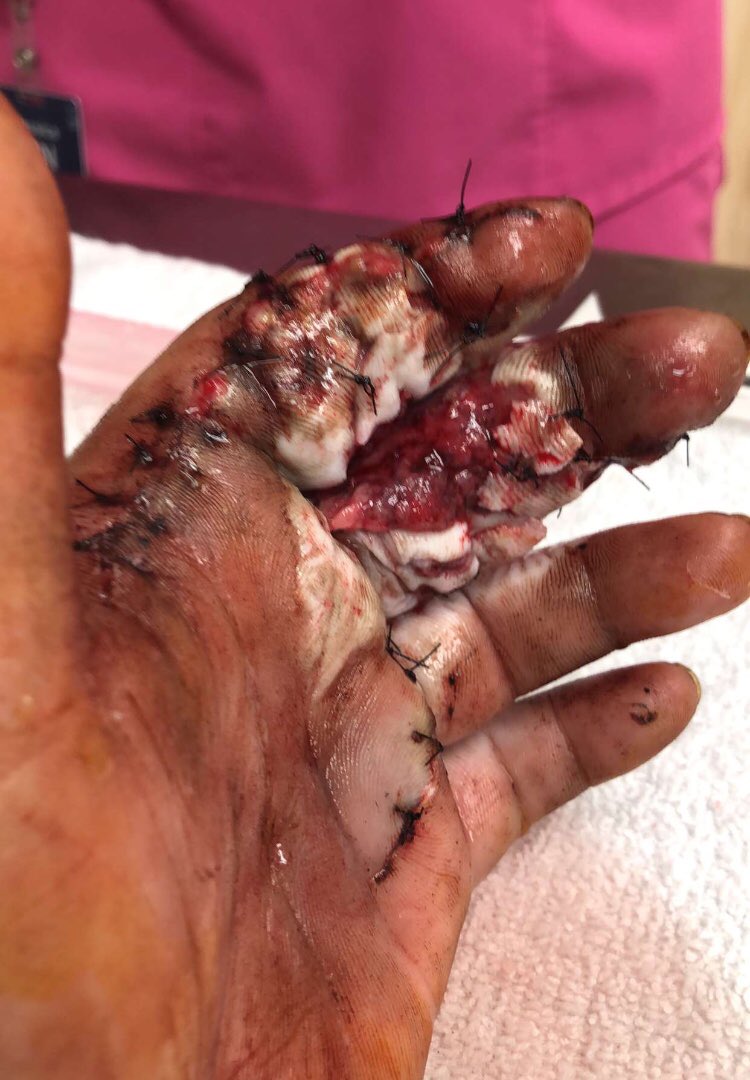 rt in 5 seconds or end up like this