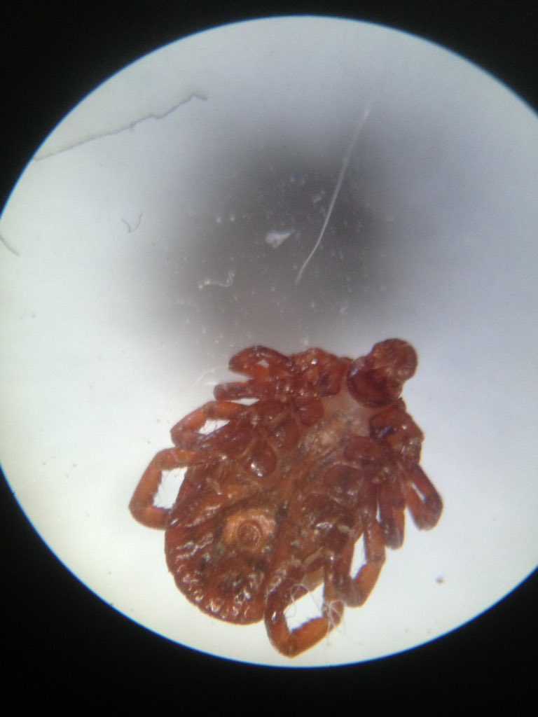 dailystem's tweet image. First tick of the summer.
Did you know a tick isn't an insect...it's an arachnid (like a spider) with 8 legs.
#SummerSTEM #BackyardScience