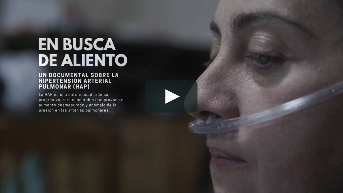 HPE_ORG's tweet photo. "La doctora me comentó, cuando ingresé, que llevaba el lado derecho del corazón inflamado, con cualquier mínimo esfuerzo me podría haber dado una parada cardíaca". Así es la Hipertensión Arterial Pulmonar #AlertaHAP. Conoce la historia de Nieves en https://t.co/O0YpwqB9uA https://t.co/jIDdSAV52i
