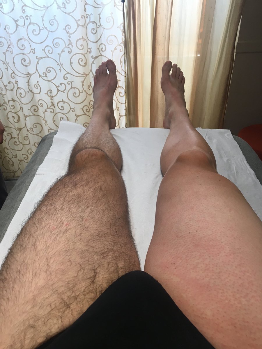 ivan_torrero's tweet photo. Oggi niente bici, ma si all’allenamento! Oggi abbiamo fatto una seduta per allenare il cervello al dolore! #ceretta #allenamentomentale #dolore #depilazione #imcycle #cycling #gambe #legs #tuttoliscio #rallydiromagna #menounchilo #namaste #cetroestetico #sanbartolomeo https://t.co/04jE02nOki
