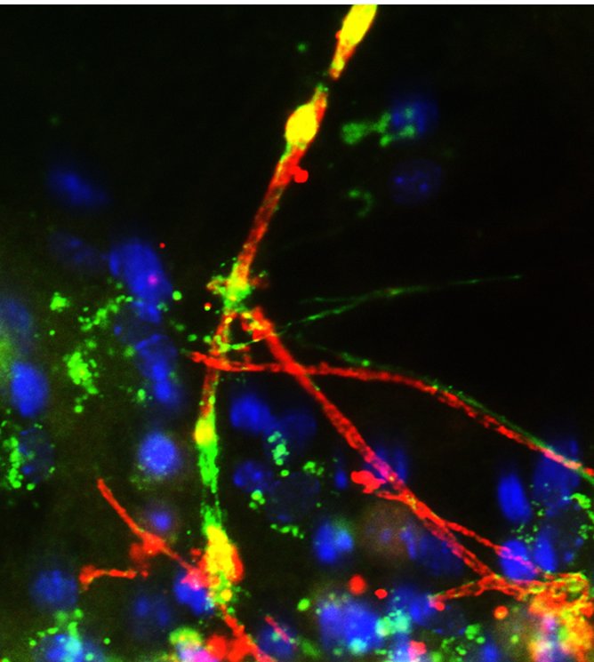 mssocietyuk's tweet photo. A very happy #WorldMSDay everyone! Let's raise awareness!

Today we're talking about treatments and we're celebrating #MSResearch! Let's start the day with these stunning visuals from #MSResearch projects. The below is a mix of stem cells, myelin cells and white matter! https://t.co/4CB9Jp9t4K