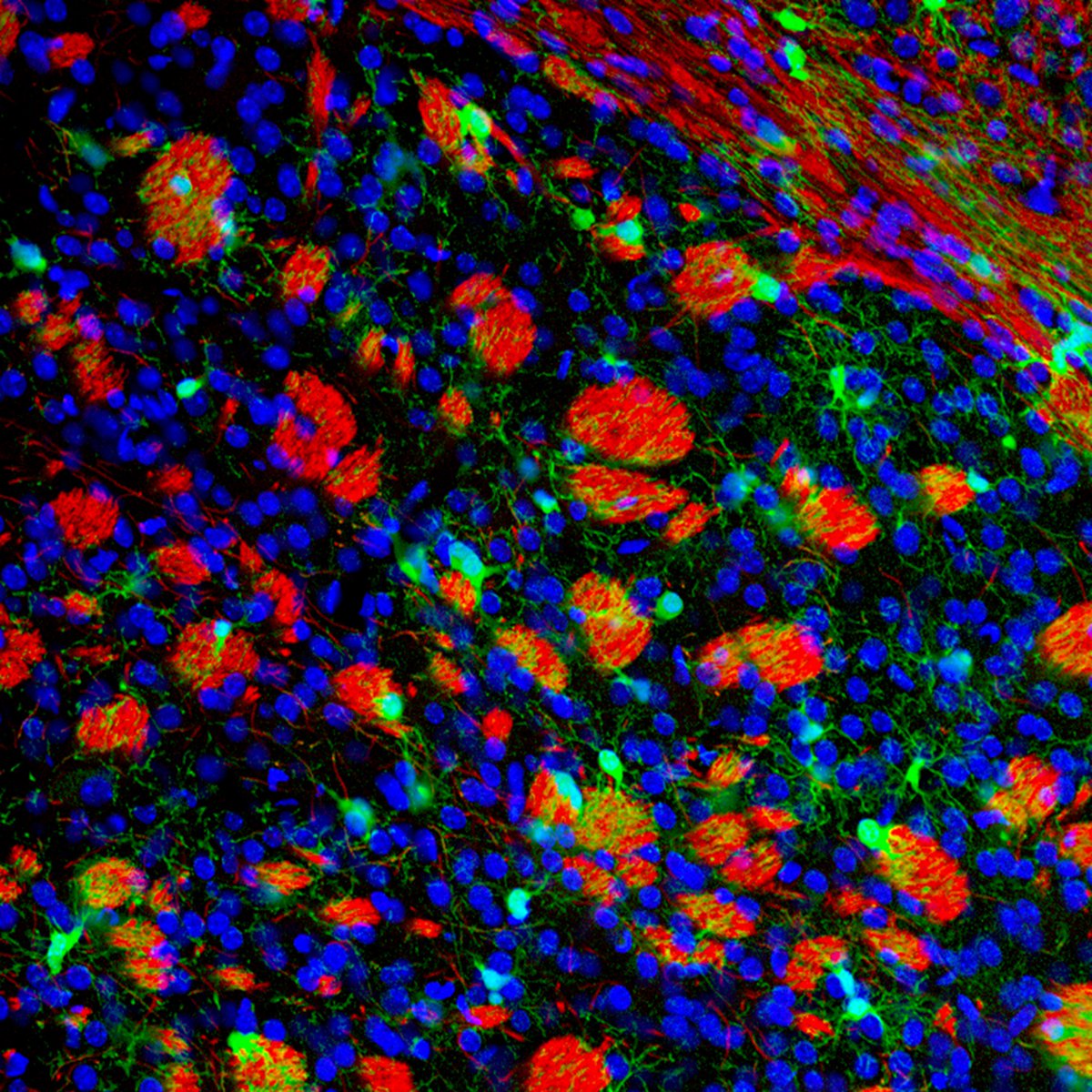 mssocietyuk's tweet photo. A very happy #WorldMSDay everyone! Let's raise awareness!

Today we're talking about treatments and we're celebrating #MSResearch! Let's start the day with these stunning visuals from #MSResearch projects. The below is a mix of stem cells, myelin cells and white matter! https://t.co/4CB9Jp9t4K