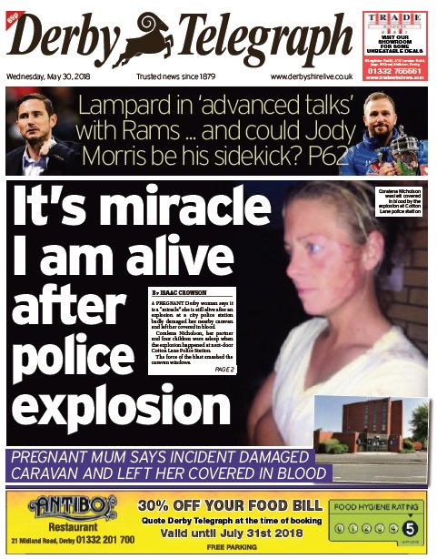 DerbyTelOffers's tweet image. It's a miracle I am alive after police explosion - See today's #DerbyTelegraph